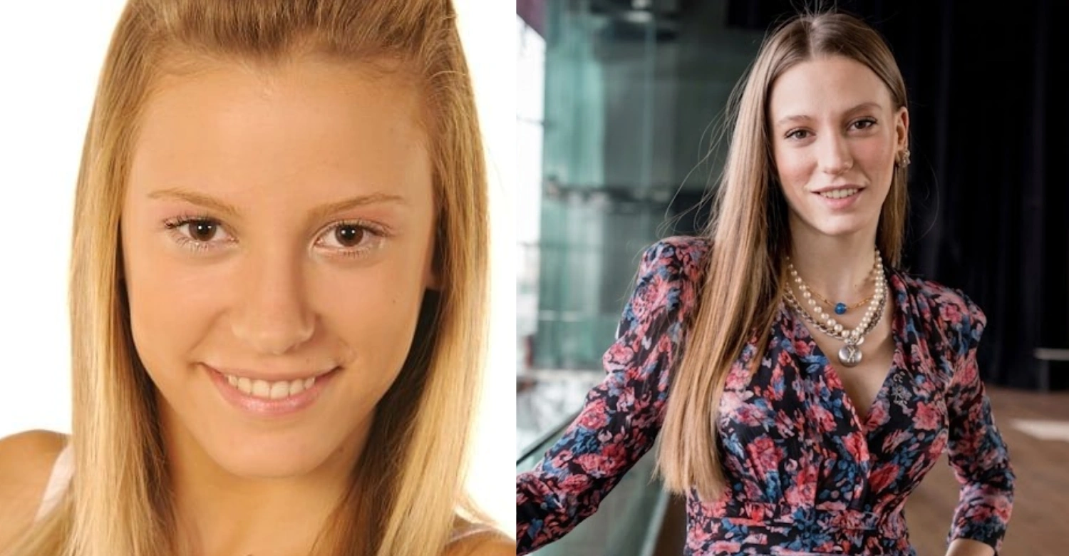 Serenay Sarıkaya before and after